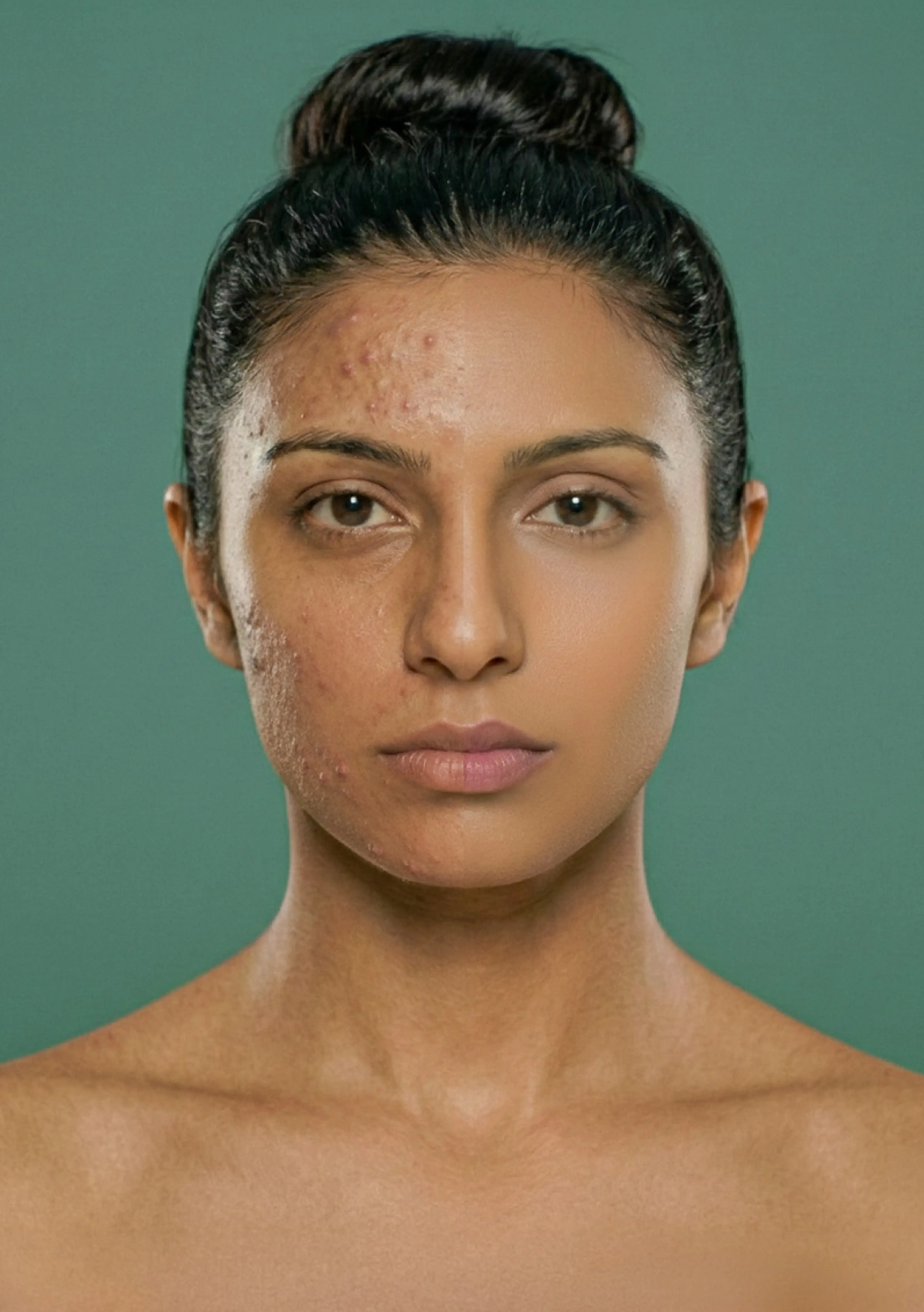 Online pigmentation and discoloration treatment with dermatologist